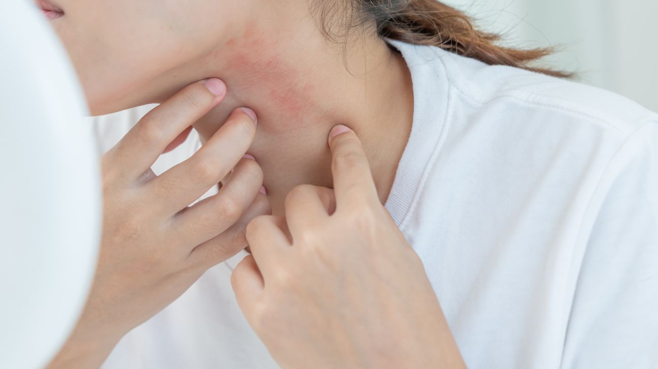 Ropa dermatitis atópica